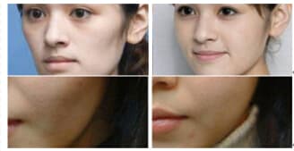 丰苹果机 时刻笑脸迎人